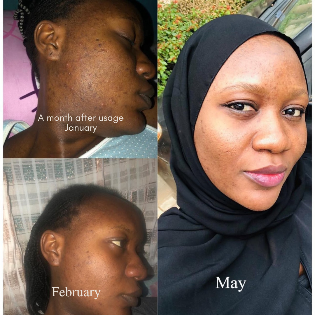 Skin Reset