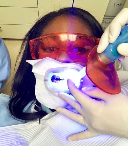 TEETH WHITENING